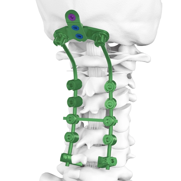 後頭頸部脊椎スクリューシステム